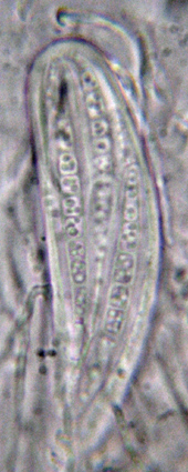 asque contenant 8 spores