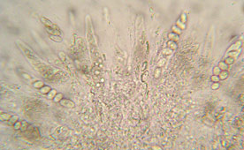 asques  8 spores