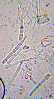 spores aciculaires cloisonnes, 24-45 x 2-2,5 m