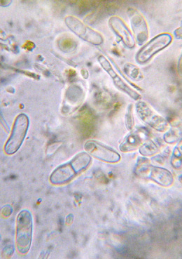 spores simples, parfois  1 cloison, 9-15 x  3-6,5 m