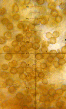 spores globuleuses, 3-8 m