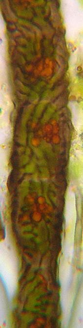 filament  paississements irrguliers vu au microscope