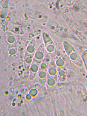 spores  1 cloison,10-14 x 2-4 m