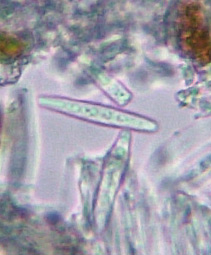 spores incolores, 5-7 cloisons, 20-40 x 4-7 m