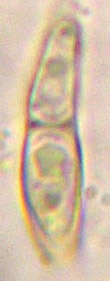spores 11-20 x 3-7 m, simples devenant cloisonne [1(2)]
