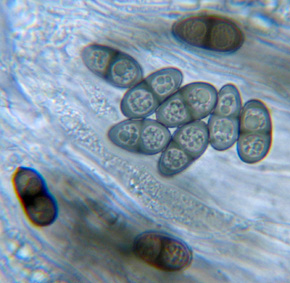 Spores bunes  1 cloison, 13-18 x 7-10 m