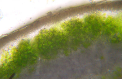 couche algale en glomrules (microscope)