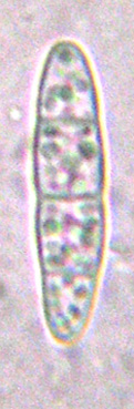 spores cloisonnes, 16-36 x 4-6 m