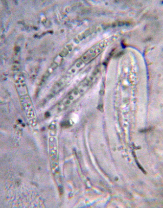 spores aciculaires droites ou lgrement courbes