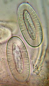 spores (125-250 x 50-85 m), (1)-2 par asque