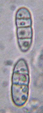 spores  3 cloisons, 8-25 x 4-6 m