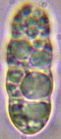 spores incolores devenant brun clair, 3cloisons  submurales, 12-20 x 3-8 m